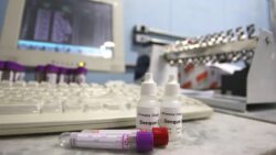 precos-do-exame-de-dengue-variam-ate-276%-entre-laboratorios-do-rio